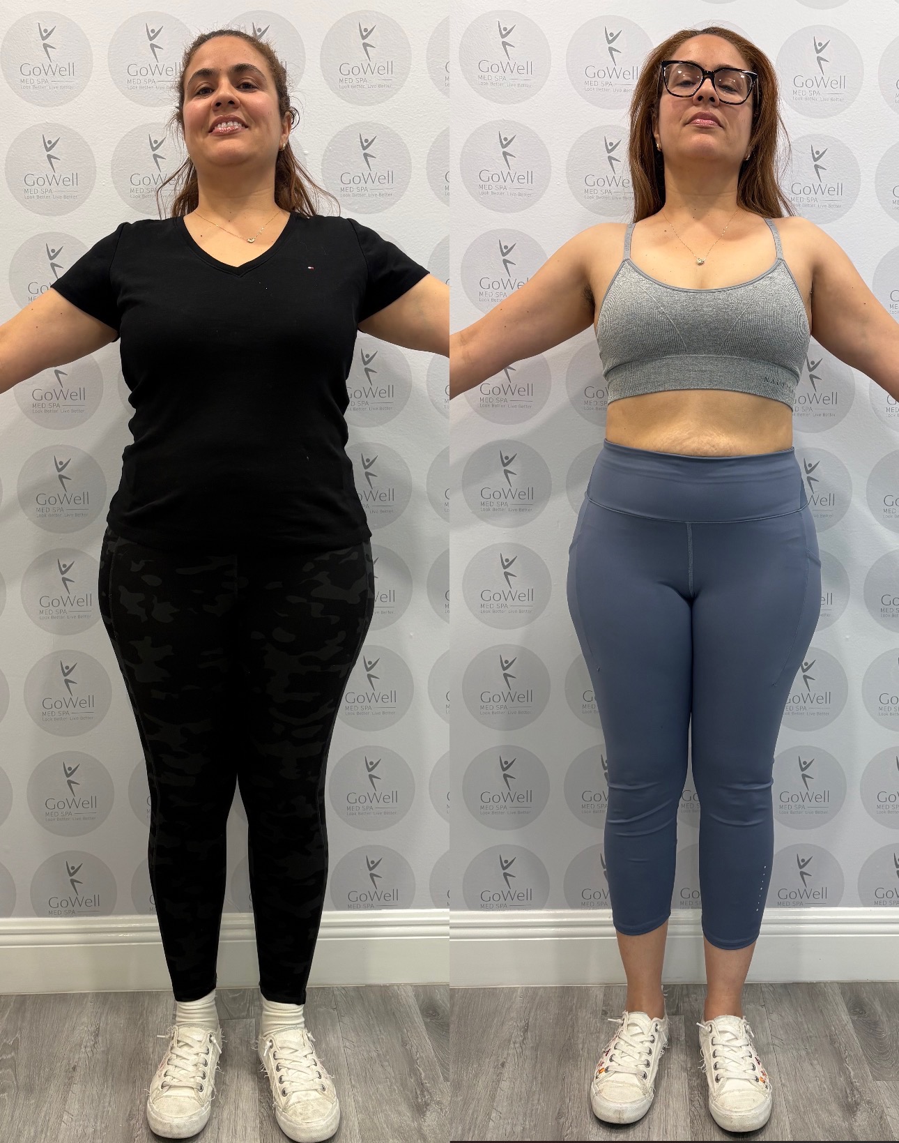 GoWell Med Spa client before and after weight loss transformation — front view