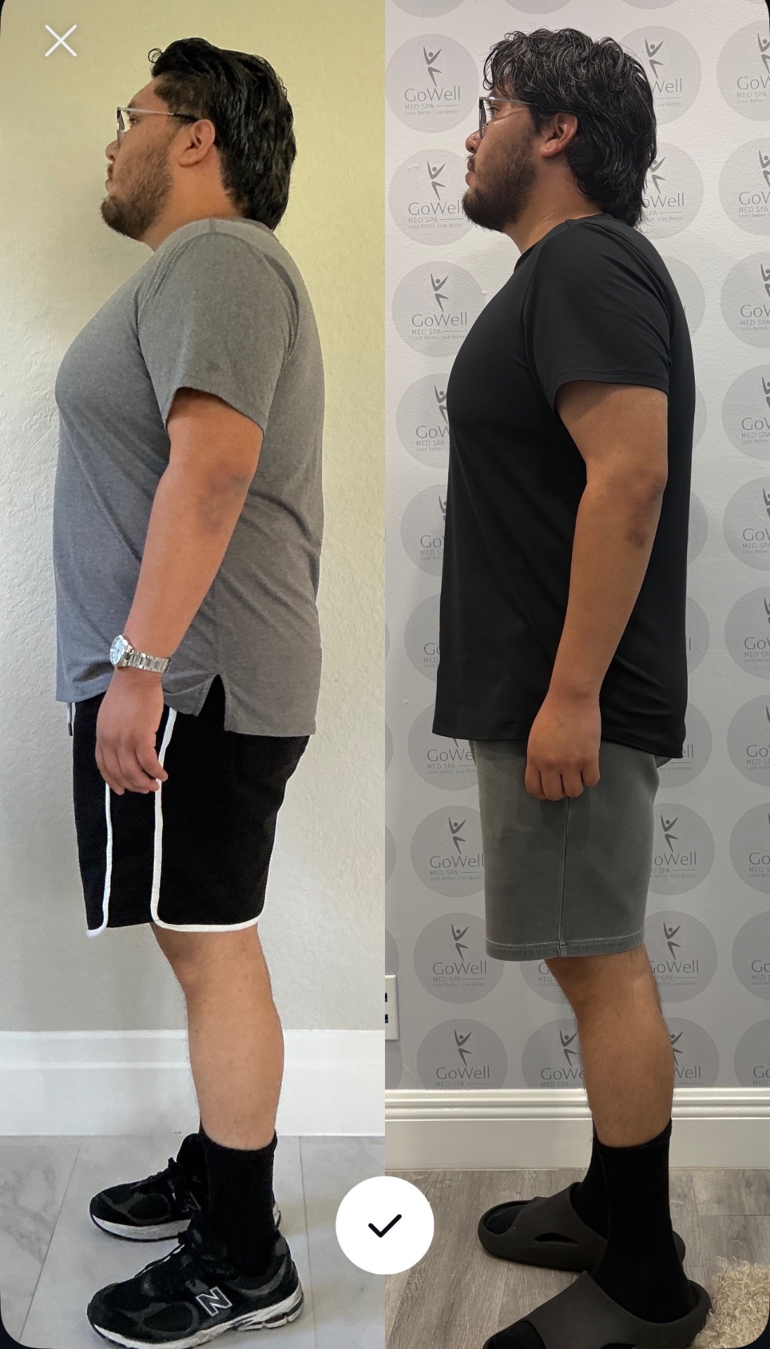 GoWell Med Spa male client before and after weight loss transformation — side profile
